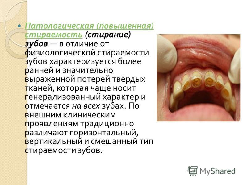 Диагностика по форме зубов Диагностика по форме зубов