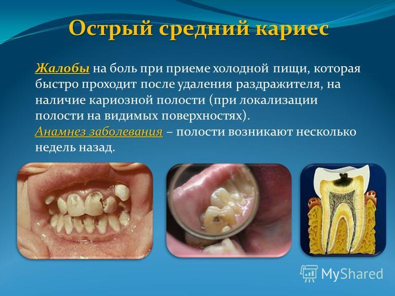 Как сделать цветы своими руками. Из:бумаги, лент, ткани Как сделать скриншот экрана, принтскрин страницы