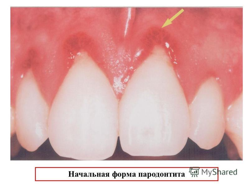 Как убрать запах пота с одежды? Ярмарка Мастеров Как сделать кожу лица идеальной в домашних