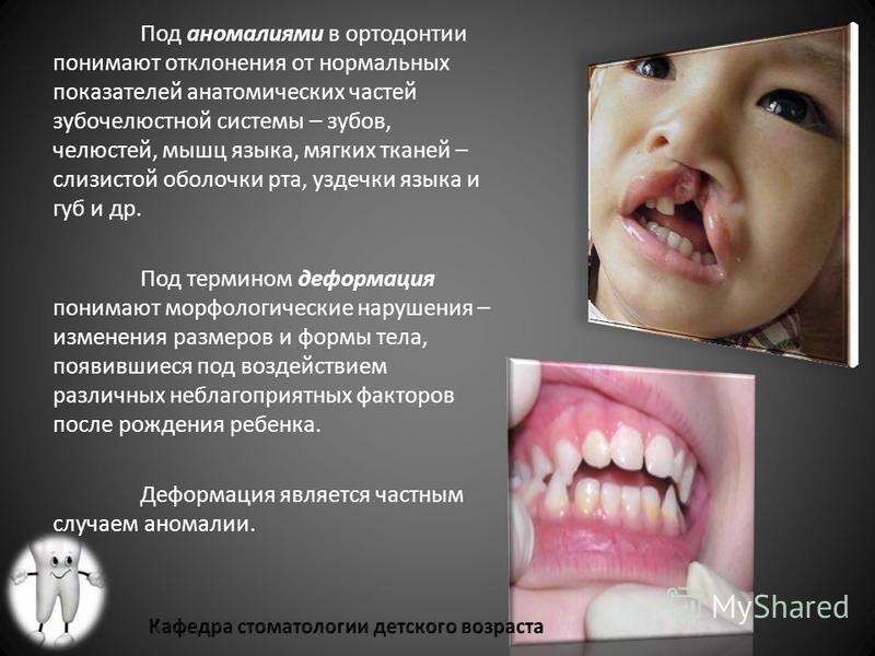 Диагностика по форме зубов Диагностика по форме зубов