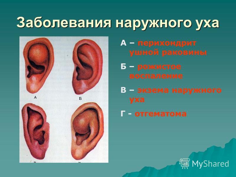 фото воспаление уха онлайн