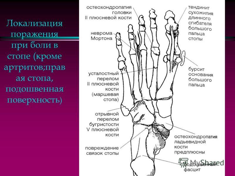 Quot;Команды Мафии" Lonsdale - Разговоры - QWERTY. Форум