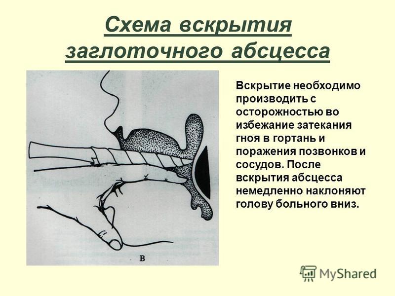 Боль в области сердца при кашле у ребенка 7 лет