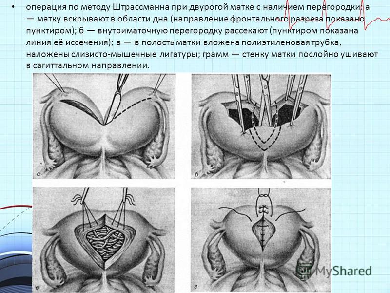 14 неделя беременности: описание, фото, узи, живот, вес, пол Двурогая матка и беременность - Pregnant-Club