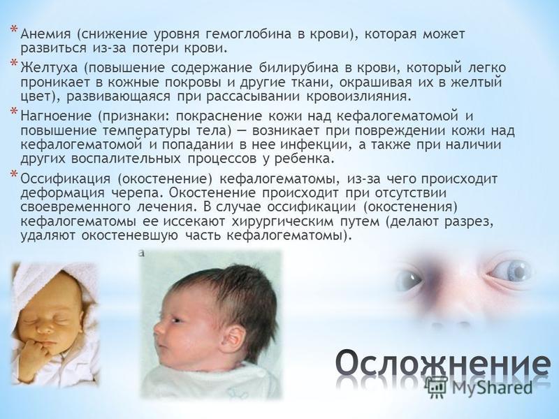 Почему у новорожденных высокий билирубин Почему у новорожденных высокий билирубин