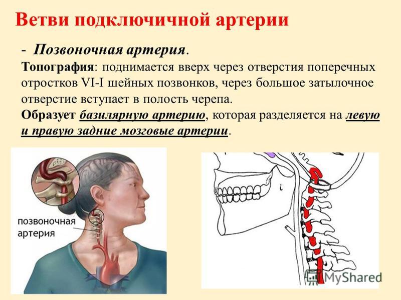 Атеросклероз позвоночника лечение Атеросклероз позвоночника лечение