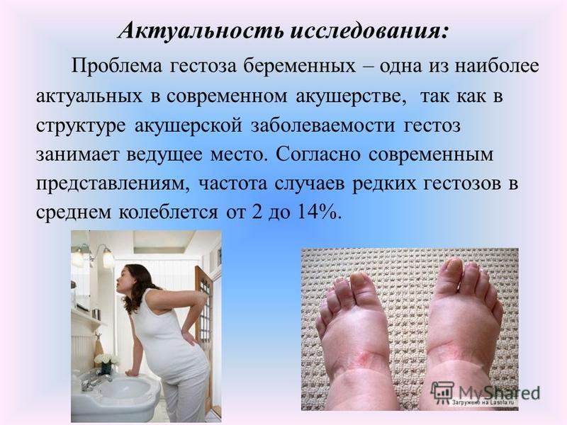 Дот тест беременным цена инвитро 66