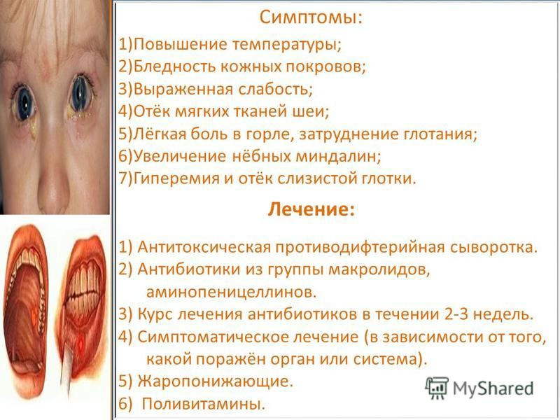 Повышение температуры боль губа Повышение температуры боль губа
