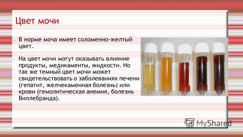 Нормальный цвет мочи у беременной 33