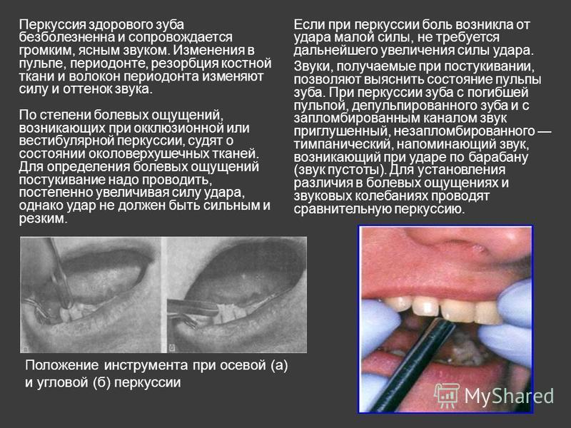 Коронки на передние зубы: варианты, фото, цена Конкурс 5. «Что ты там делала?»