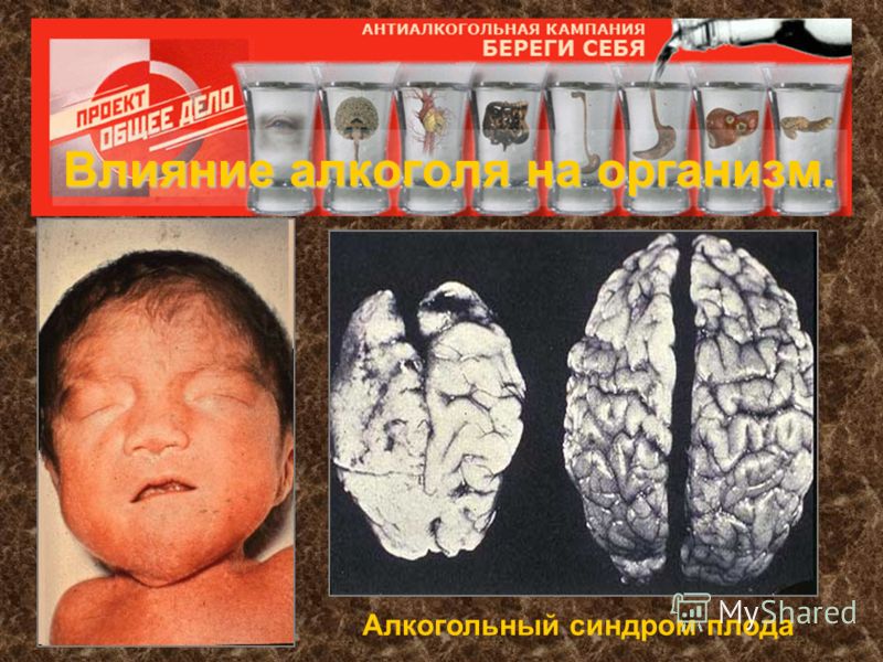 Какие лекарства лечат при алкогольной зависимости