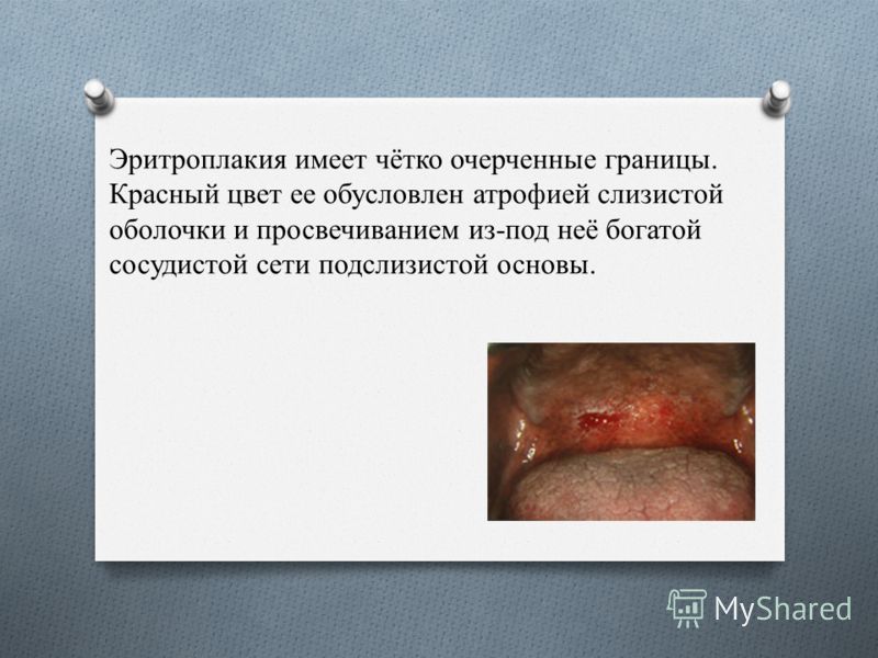 запах табака изо рта чем убрать запах табака изо рта чем убрать