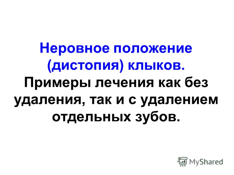 Промежутки между зубов верхних Промежутки между зубов верхних