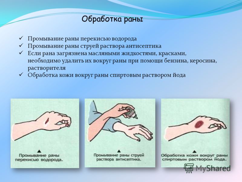 Если рана без кожи Если рана без кожи