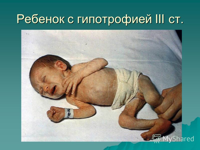 Мастер-класс по стрижке горячей бритвой - Обучение - VOLOSY. ORG Масло зародышей пшеницы для лица: отзывы о применении маски из пшеничных