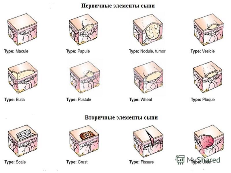 Крупноворсистый вид кожи который из Крупноворсистый вид кожи который из