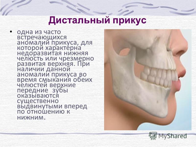Нижняя челюсть связана с Нижняя челюсть связана с