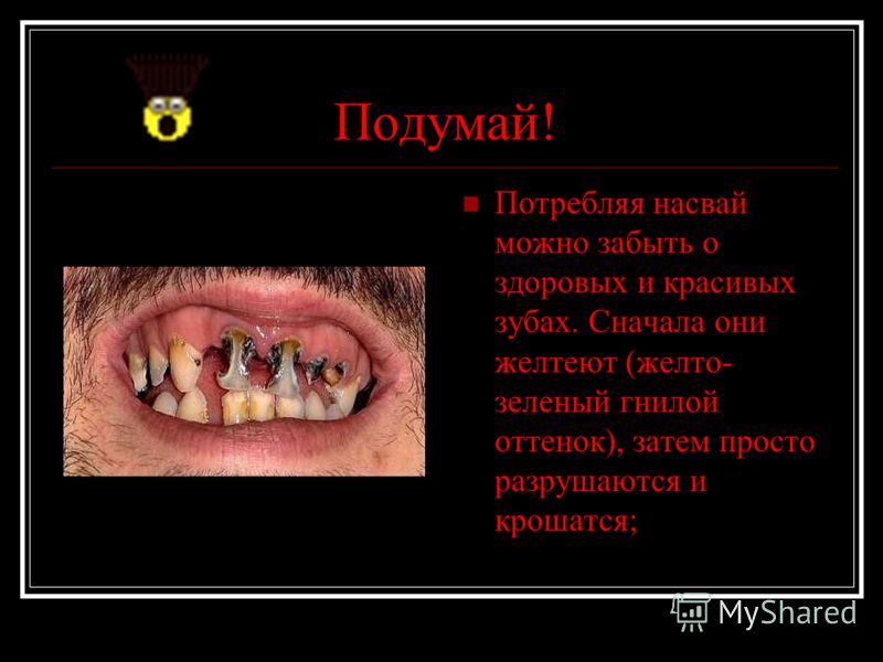 у подростка запах изо рта причины у подростка запах изо рта причины