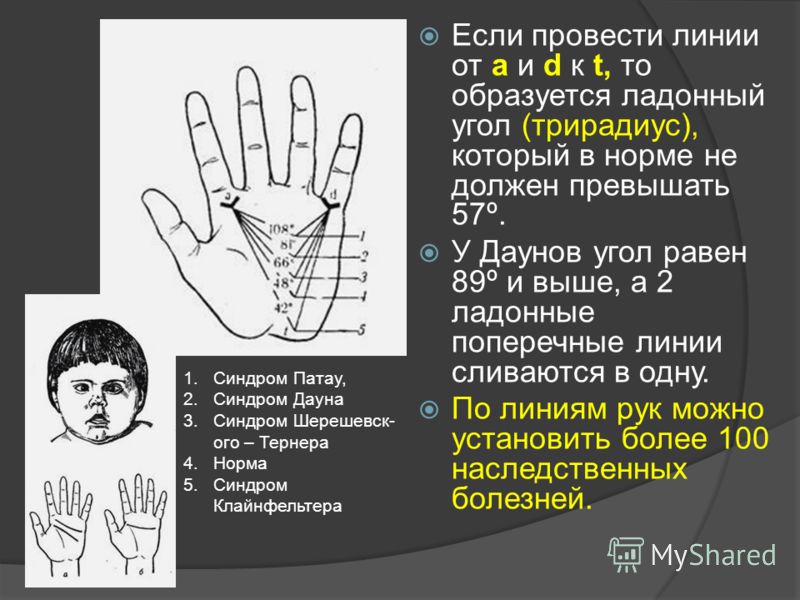 Ноющая боль в яичнике во время месячных
