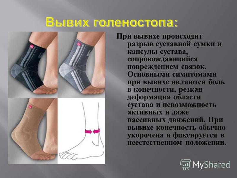 Повреждение суставной капсулы анкилоз височно-нижнечелюстного сустава.классификация, диогностика, этиология, патогенез