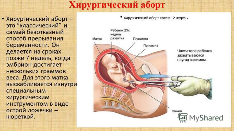 Как прервать беременность домашний метод Как прервать беременность домашний метод