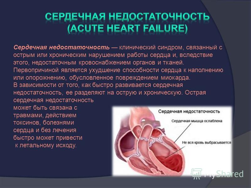 Сердечная недостаточность клинический синдром, связанный с острым или хроническим нарушением работы сердца и, вследствие этого, недостаточным кровоснабжением органов и тканей. Первопричиной является ухудшение способности сердца к наполнению или опоро