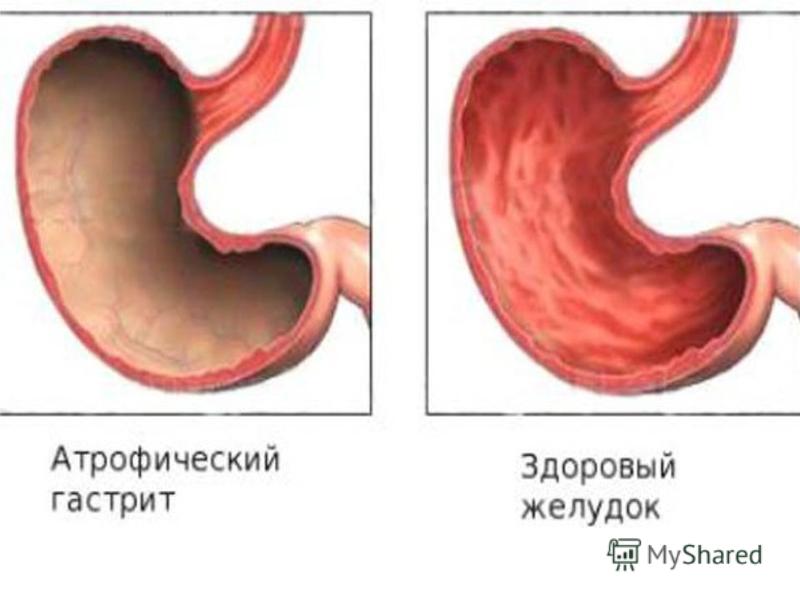 [PUNIQRANDLINE-(au-dating-names.txt) 28 Хвороби шлунково кишкового тракту реферат 2645