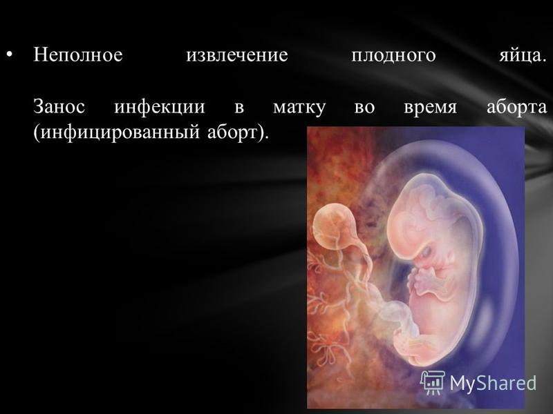 Нормальная беременность должна длиться не 9 месяцев, как. - МК Маша и Медведь все серии подряд смотреть онлайн