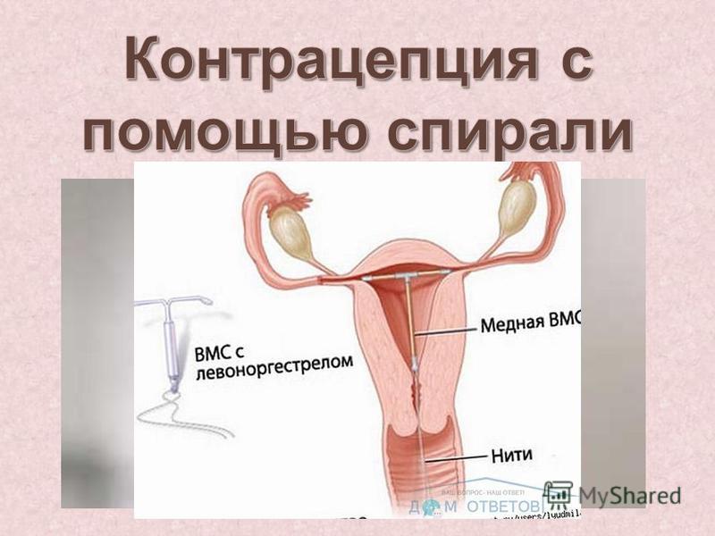 Что такое ппа беременность Что такое ппа беременность