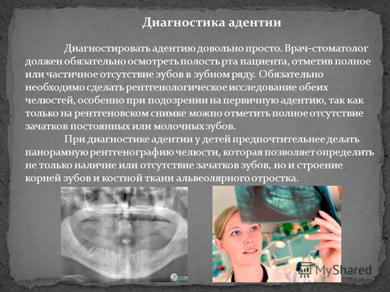Особенности обследования при частичной отсутствии зубов Особенности обследования при частичной отсутствии зубов