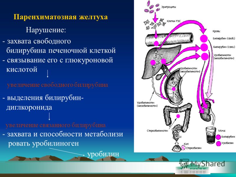 Если болит печень понос бывает