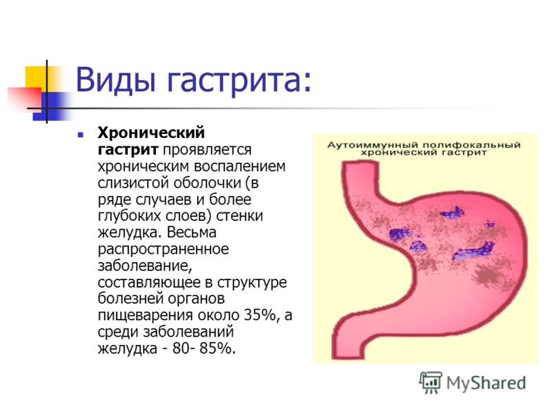 Диагноз лимфосаркома лечение