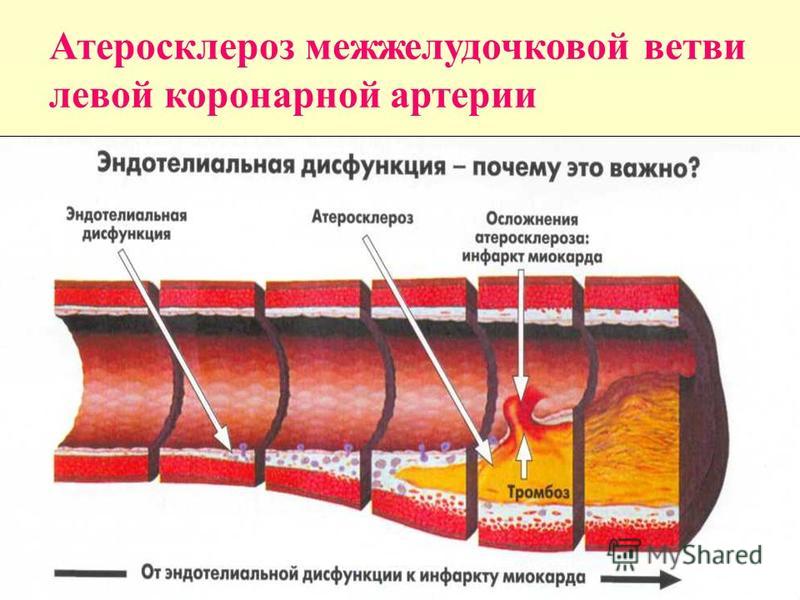 Продукты содержащие большое кол во холестерина