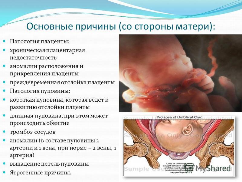 Лечение гиперплазии плаценты - Глория Мед Лечение гиперплазии плаценты - Глория Мед