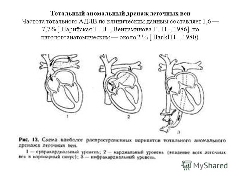 Болят вены по всему телу причины
