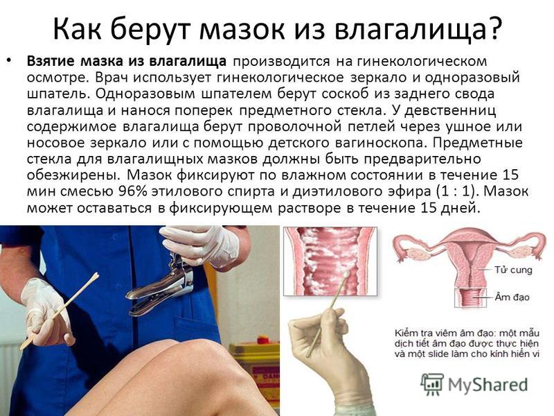 Воспаление в мазке гинеколог Воспаление в мазке гинеколог