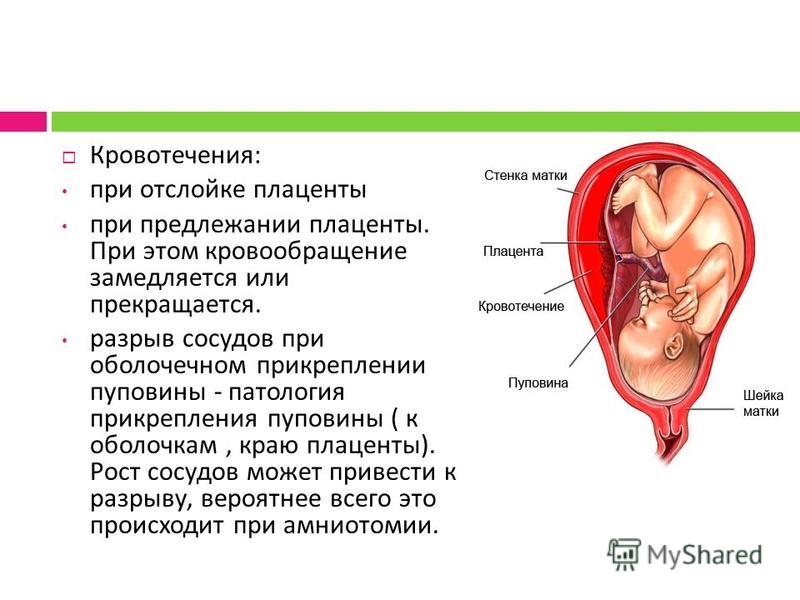 Готовые наборы в роддом Гормоны при планировании беременности Список и норма