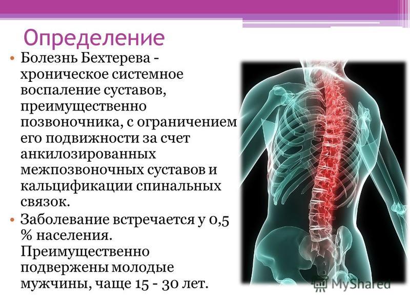Лекарства от суставов в индии Лекарства от суставов в индии