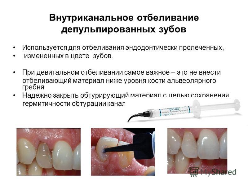 Внутрикоронковое отбеливание депульпированного зуба это Внутрикоронковое отбеливание депульпированного зуба это
