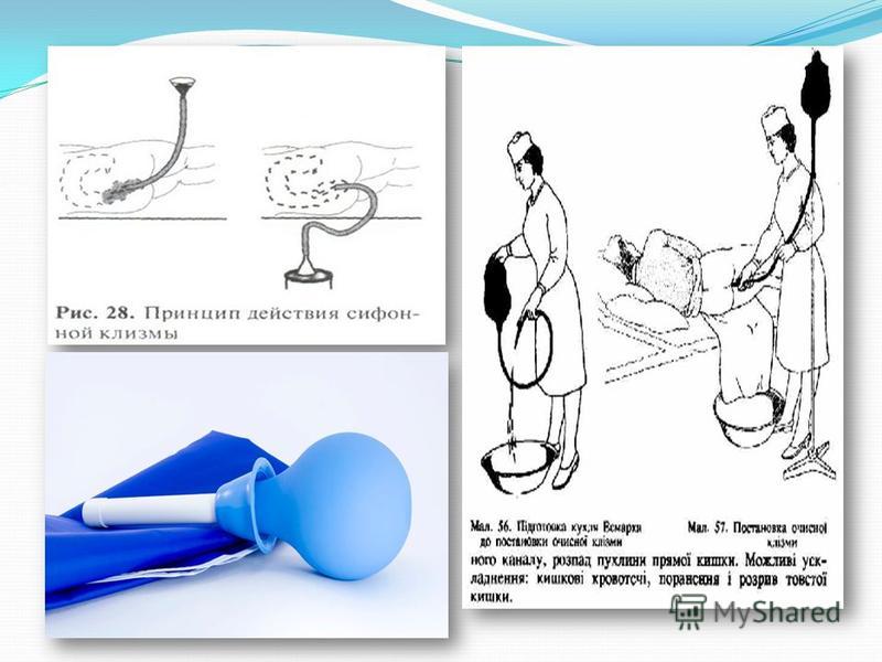 Как сделать клизму грушей самому Как сделать клизму грушей самому