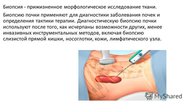 Для чего делают биопсию кожи Для чего делают биопсию кожи