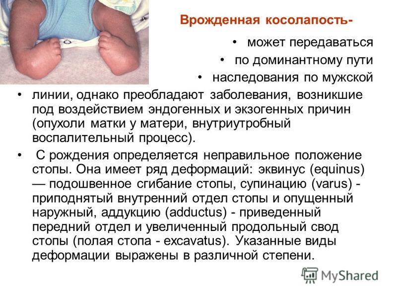 Передается ли рост по наследству разрыва
