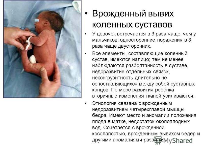 Вывих коленного сустава симптомы Вывих коленного сустава симптомы