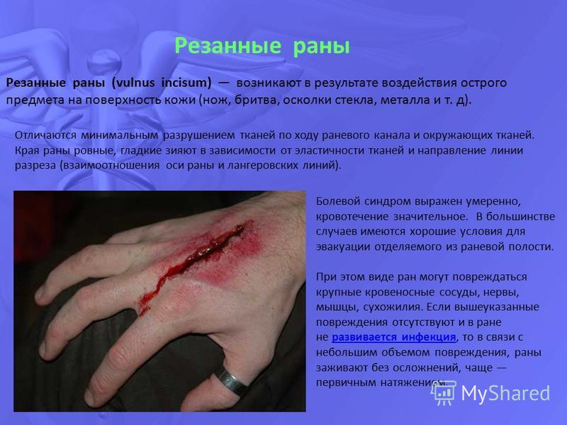 Рана поверхность кожи Рана поверхность кожи