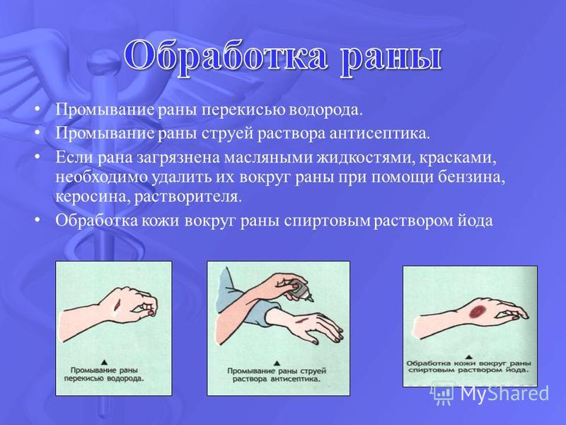 Гнойные раны лечение в домашних условиях народными средствами Гнойные раны лечение в домашних условиях народными средствами
