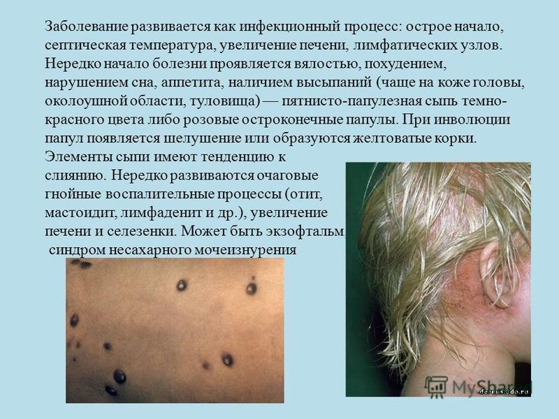 Магазины для будущих мам в Усть-Каменогорске, узнать адреса Как избавиться от постакне? - LadiesProject