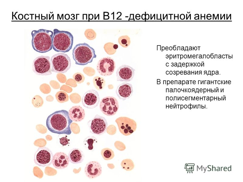 Беременность и анемия пальцев Беременность и анемия пальцев