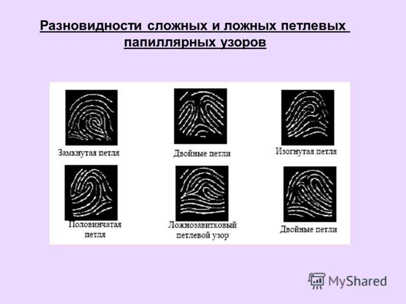 Свойства и типы папиллярных узоров Свойства и типы папиллярных узоров