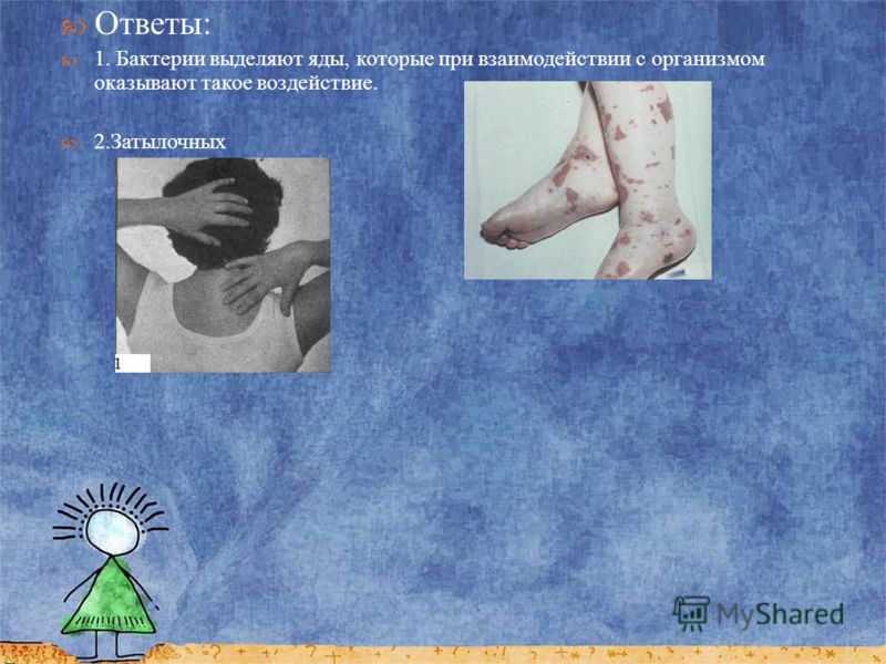 Почему появляется сыпь на всем теле Почему появляется сыпь на всем теле