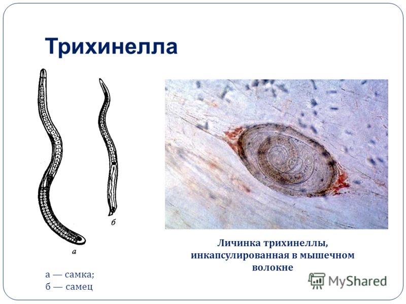 паразиты в нервной системе человека паразиты в нервной системе человека